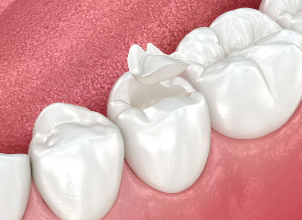 Our Range of Dental Services in Gold River, CA